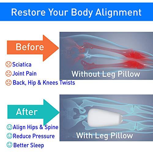LVOPO LVOPO Knee Pillow for Side Sleepers with Elastic Strap, Memory Foam Leg Pillow, Ideal for Spine Alignment, Hip, Back & Joint Pain Relief, for Better Sleeping with Breathable & Washable Cover