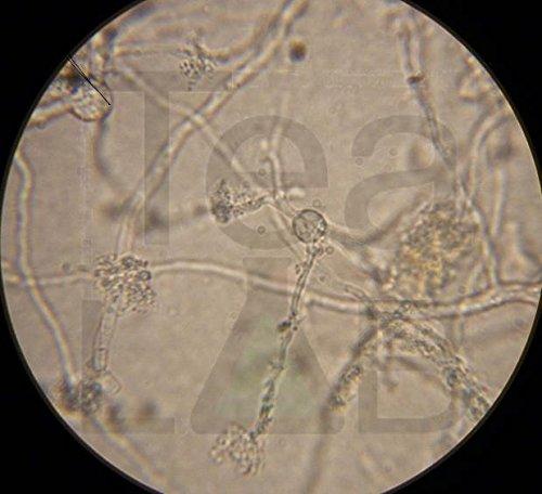 TeaLAB Compost Tea Brew Bag : 400 Micron Nylon Mesh, Made To Last in the USA (5 Gallon Bucket Sized (9\"x14\"))