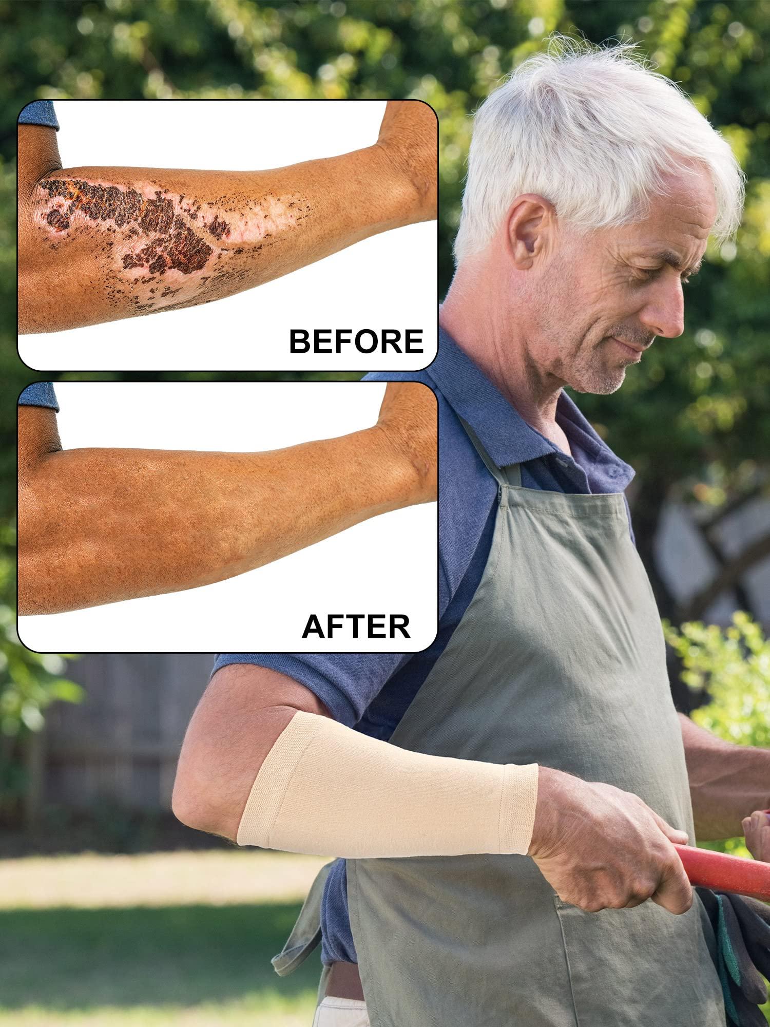 Janmercy Janmercy 9 Pairs Arm Protectors for Thin Skin and Bruising Arm Guards Elderly Protective Sleeves for Arms Gardener Working(Beige)