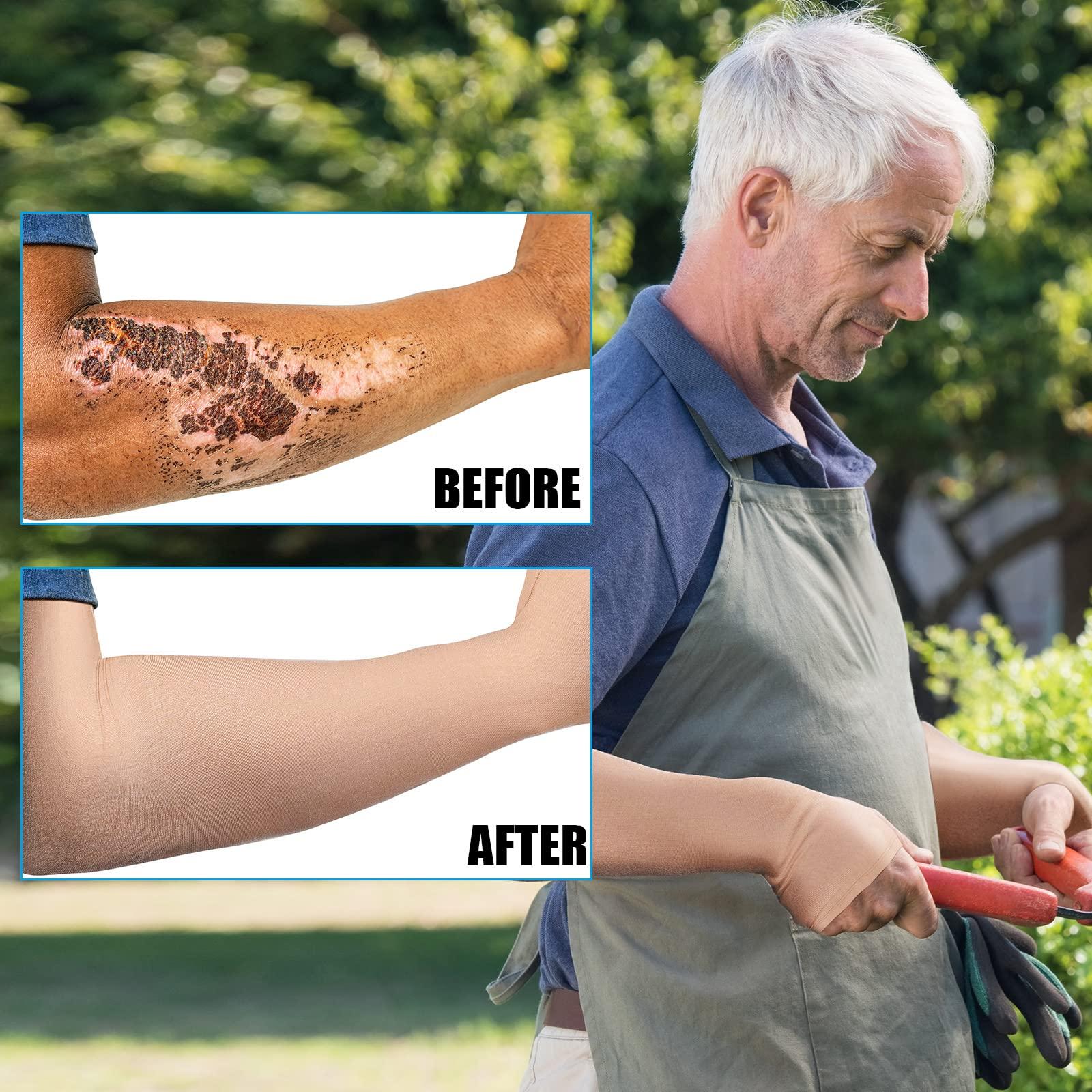 Coume Coume 2 Pairs Elderly Skin Protection Sleeves Arm Protector for Thin Skin Bruising for Men Women(Elegant Style,Medium)