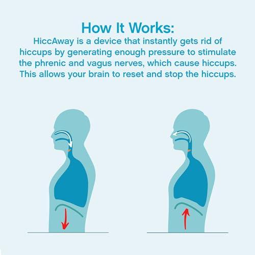 HICCAWAY HiccAway Hiccup Straw - Stops Hiccups Naturally & Fast - As Seen On Shark Tank - Clinically Proven Relief for All Ages, Children & Adults - Safe, Lightweight, & Reusable (HiccAway VERI PERI) 1 Pack